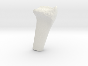 Wrist Model - Distal Radius in White Natural Versatile Plastic