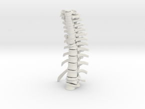 Thoracic Spine - Fracture (SKU 019) in White Natural Versatile Plastic