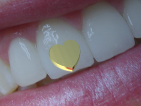 Tooth Art- Heart in 14K Yellow Gold