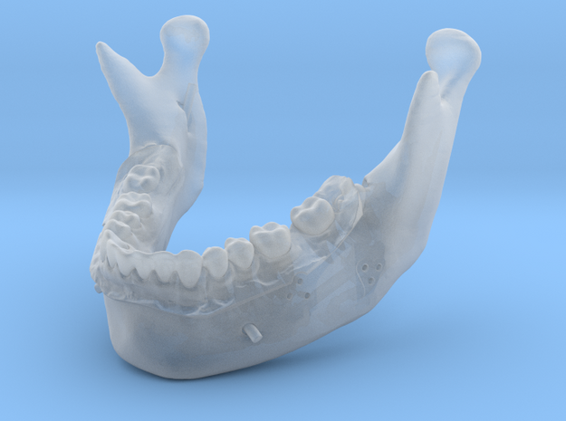 Subject 0.h | Mandible (After) in Tan Fine Detail Plastic