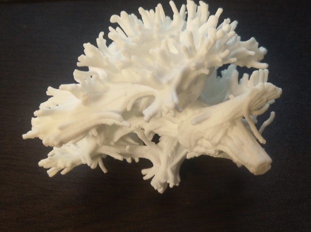 White Matter Tractography in White Natural Versatile Plastic