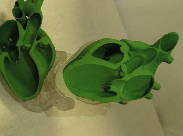 Parasternal long axis 1 in Green Processed Versatile Plastic