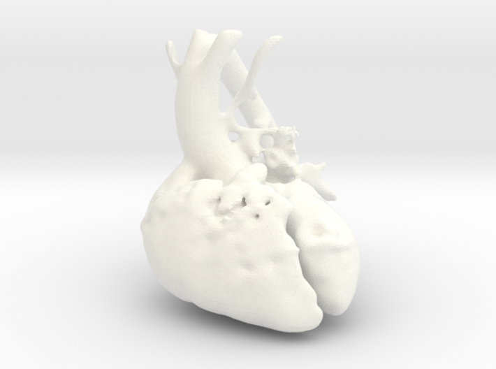 Paediatric Heart 3d printed