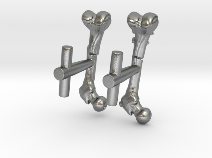 Femur Fracture and Fixation Cufflinks 3d printed
