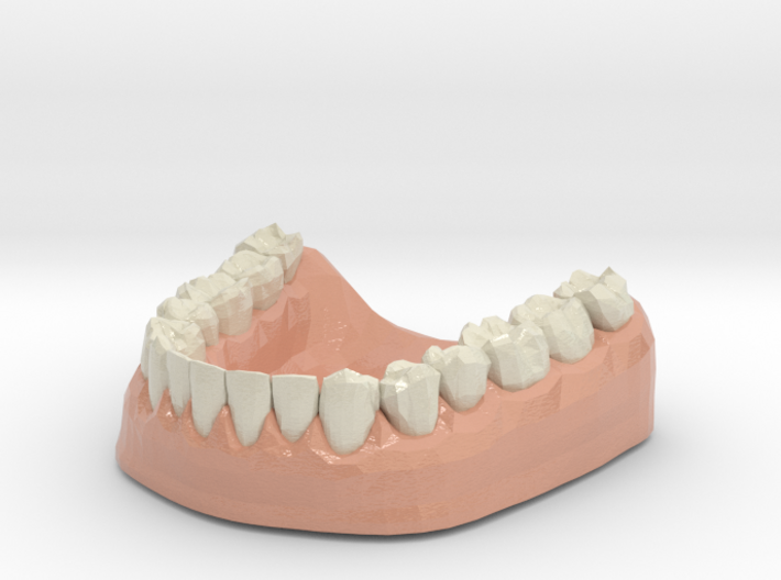 3D Teeth lower 3d printed