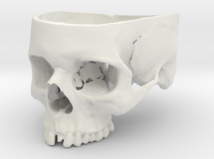 Human Skull Bowl (Life Size) 3d printed