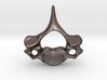 Cervical Neck Vertebra from a Human 3d printed 