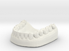 3D Teeth lower 3d printed 