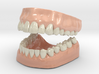 3D Teeth and Gum 3d printed 
