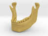 Subject 3a | Mandible (Before) 3d printed 